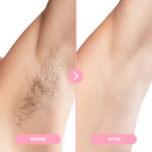 Load image into Gallery viewer, 1x Epilator