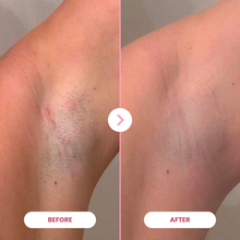 Load image into Gallery viewer, 1x Epilator